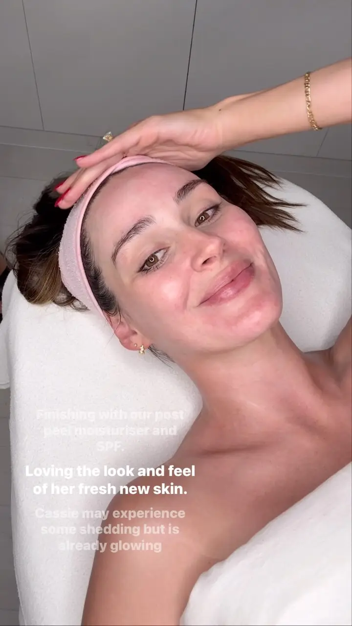 Instagram post thumbnail