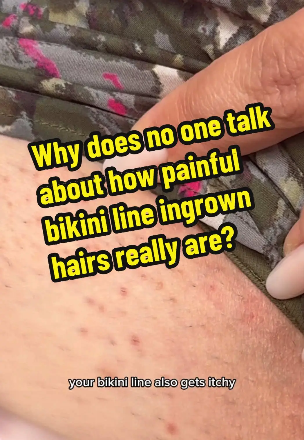 Tiktok post thumbnail