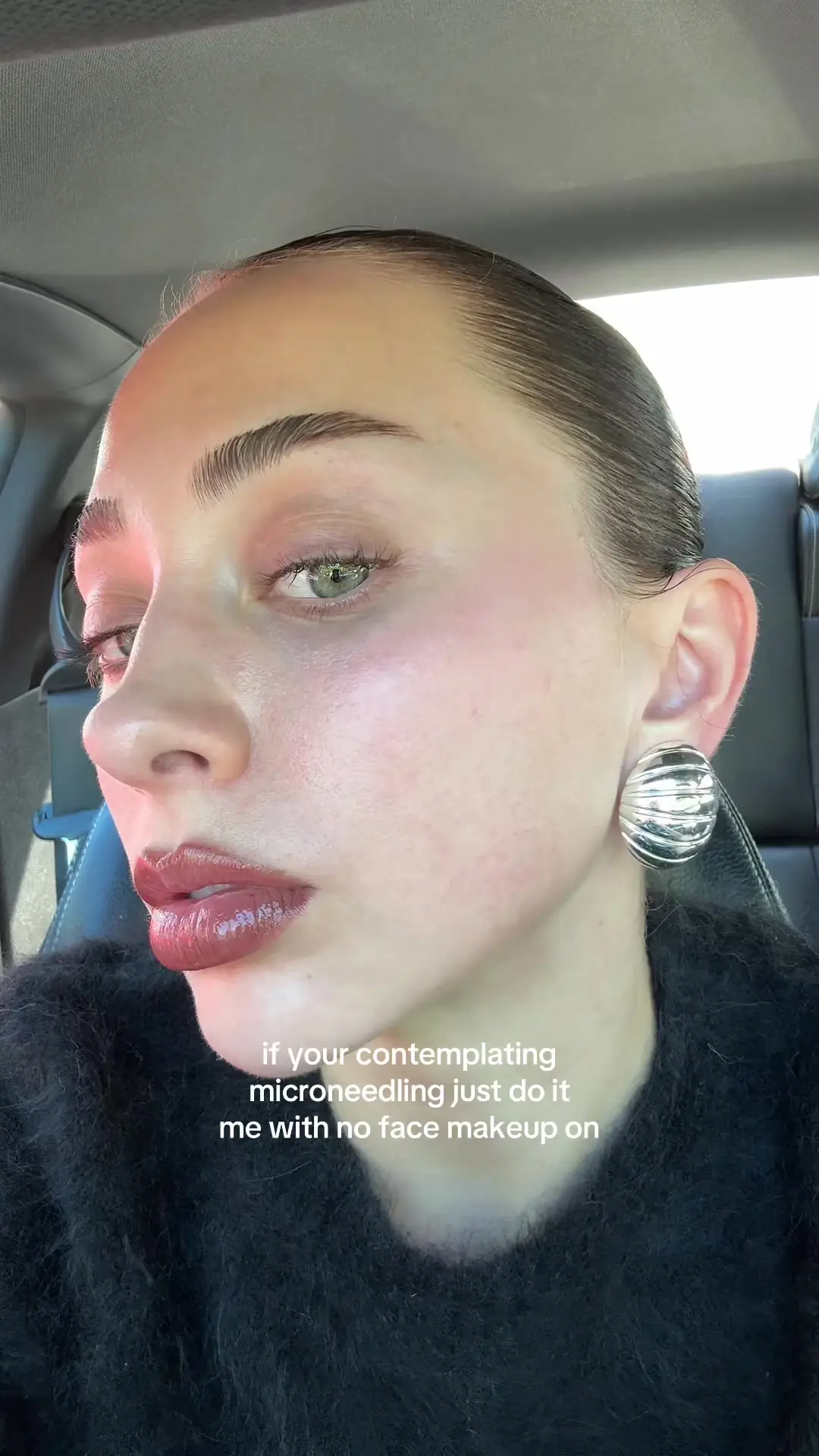 Tiktok post preview 3 from @brokeadultgirl