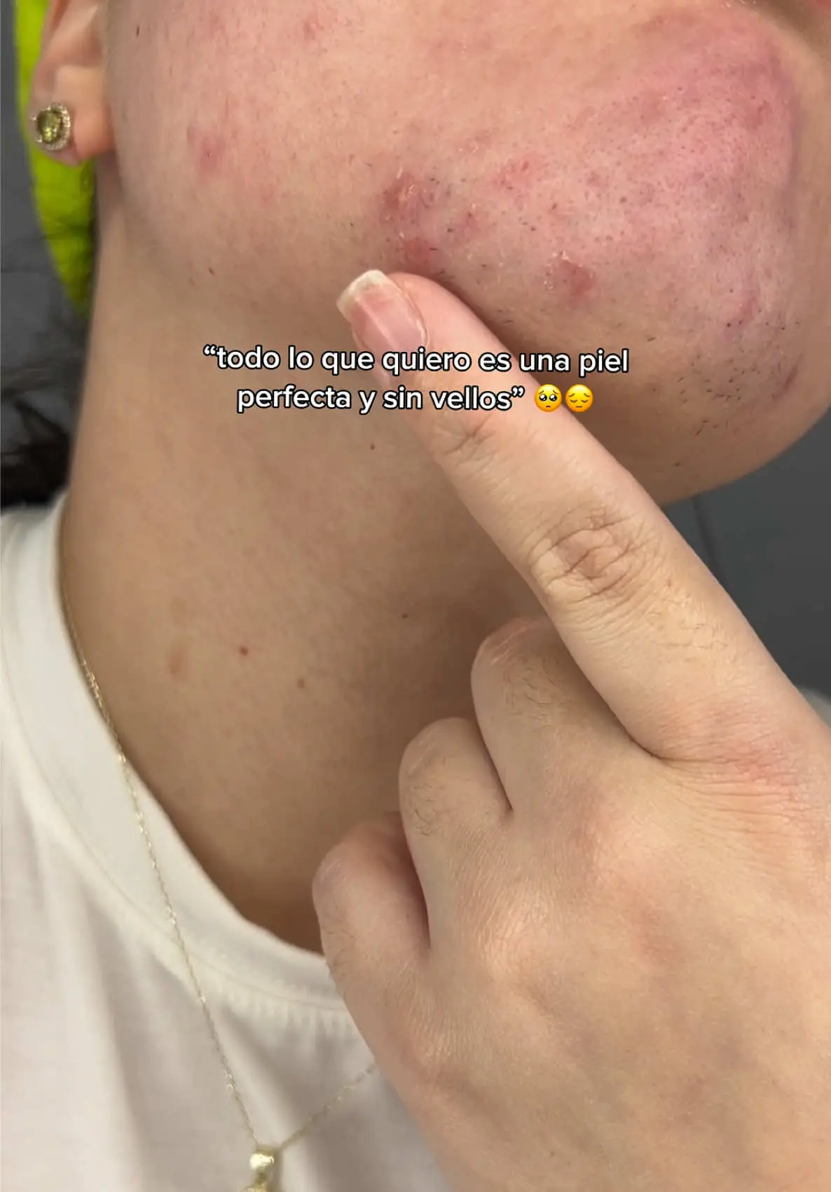 Tiktok post thumbnail