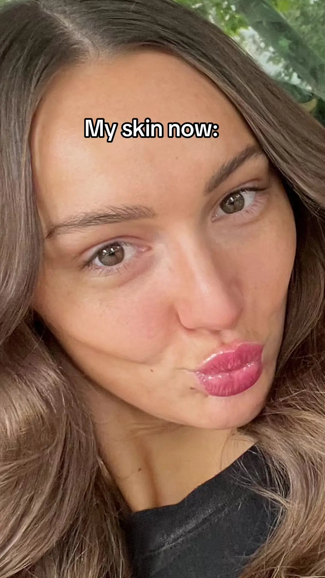 Tiktok post thumbnail
