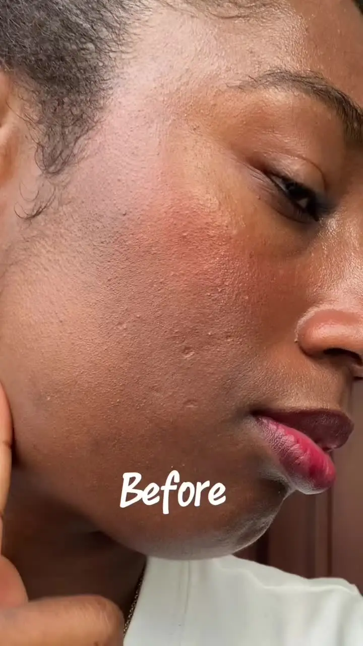 Tiktok post thumbnail