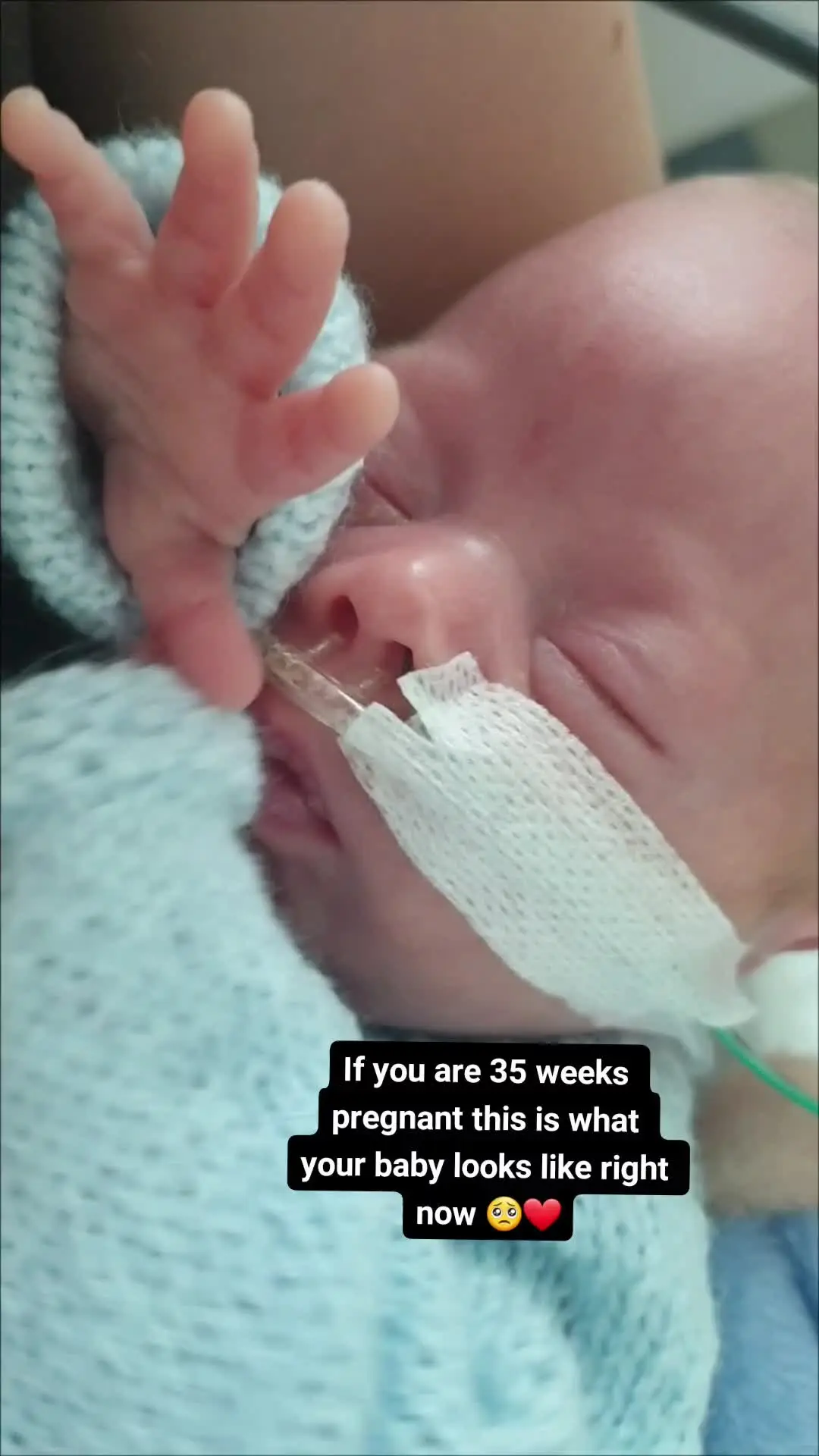 Tiktok post preview 2 from @babymasonsmummy