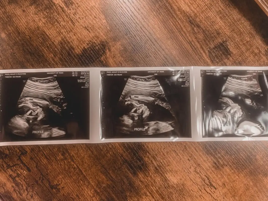 Instagram post thumbnail