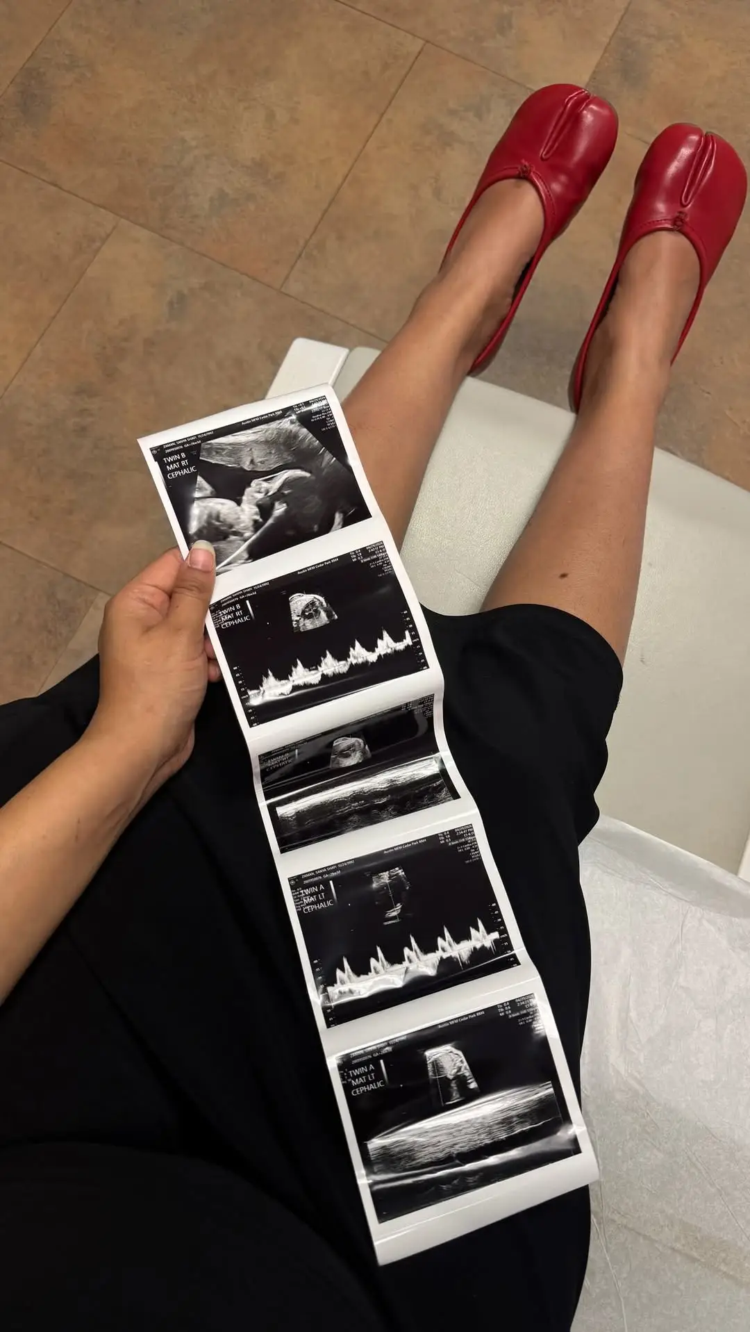 Instagram post thumbnail