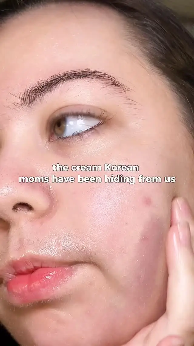 Instagram post preview 2 from glowwithrosacea_