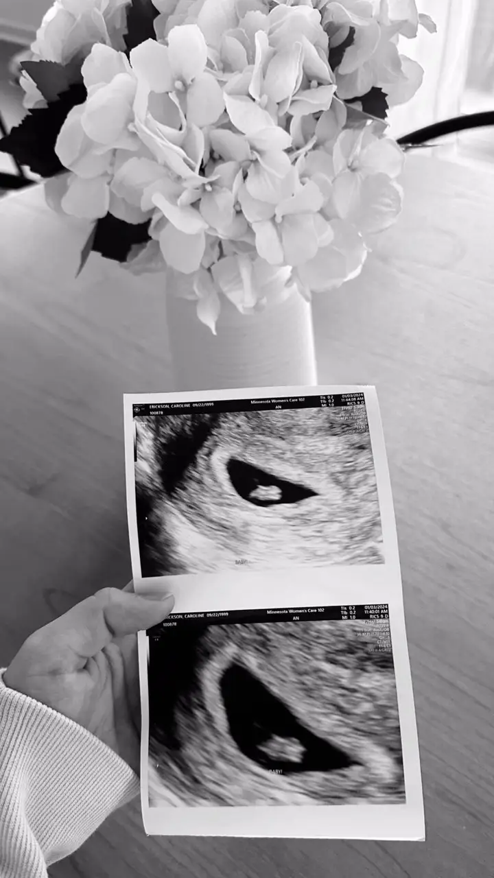 Instagram post thumbnail
