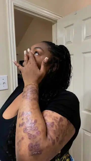 Instagram post thumbnail