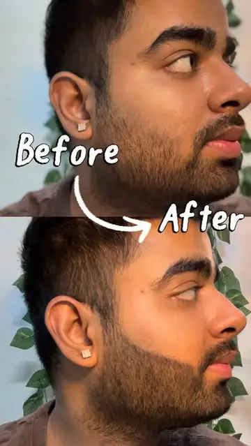Instagram post thumbnail