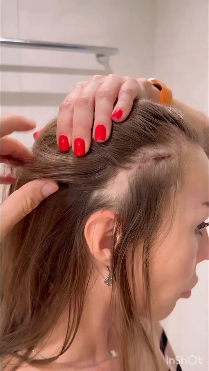 Instagram post thumbnail