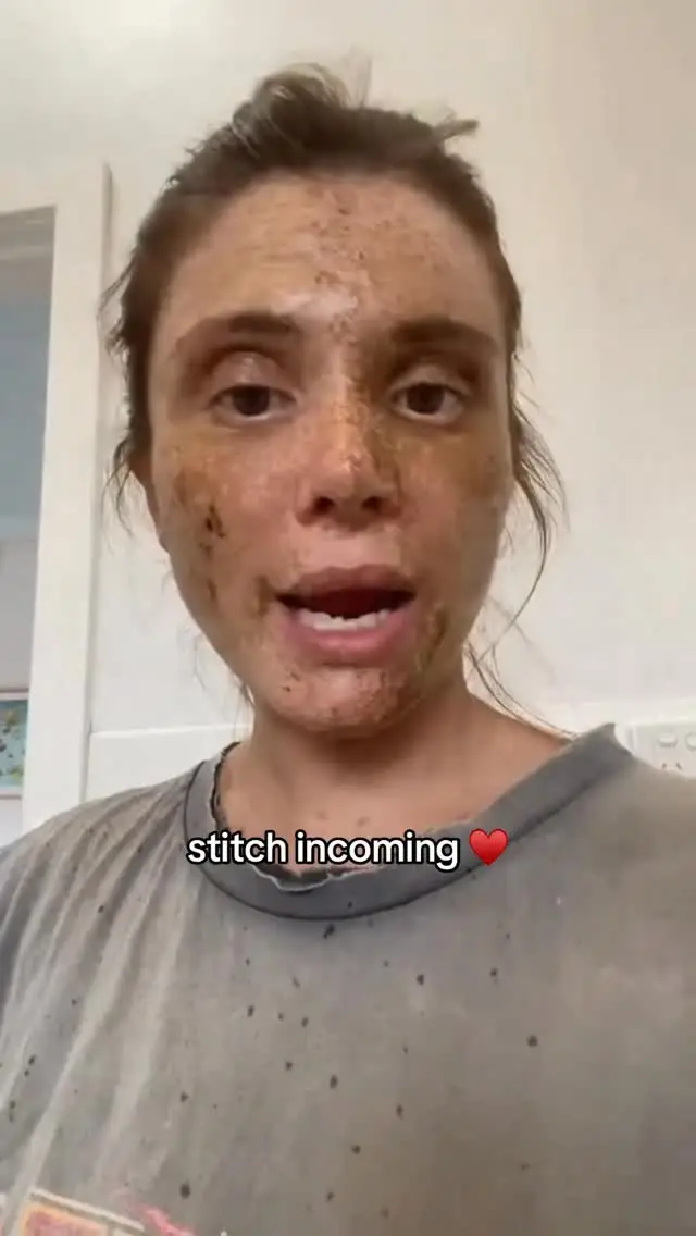 Instagram post thumbnail