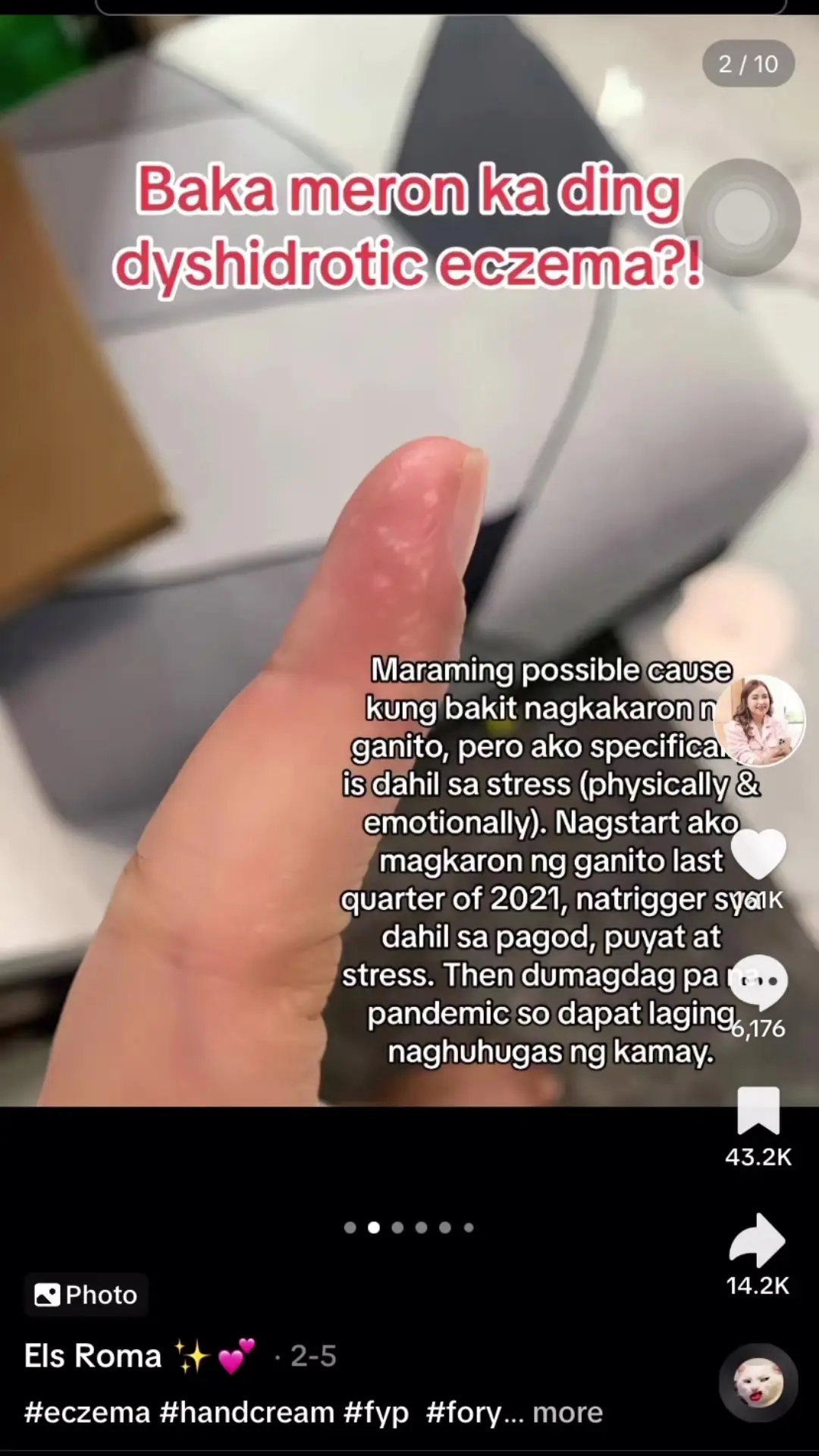 Tiktok post thumbnail