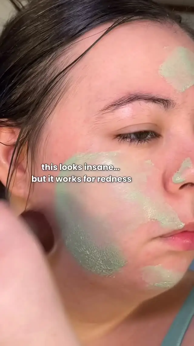 Instagram post preview 3 from glowwithrosacea_