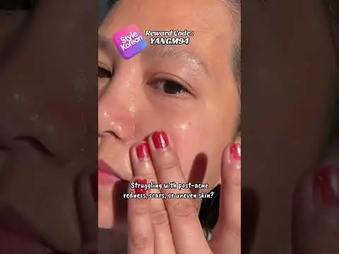 Youtube post thumbnail