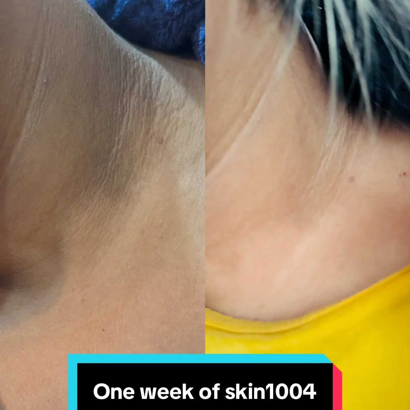 Tiktok post preview 2 from @bhattarai_oshin