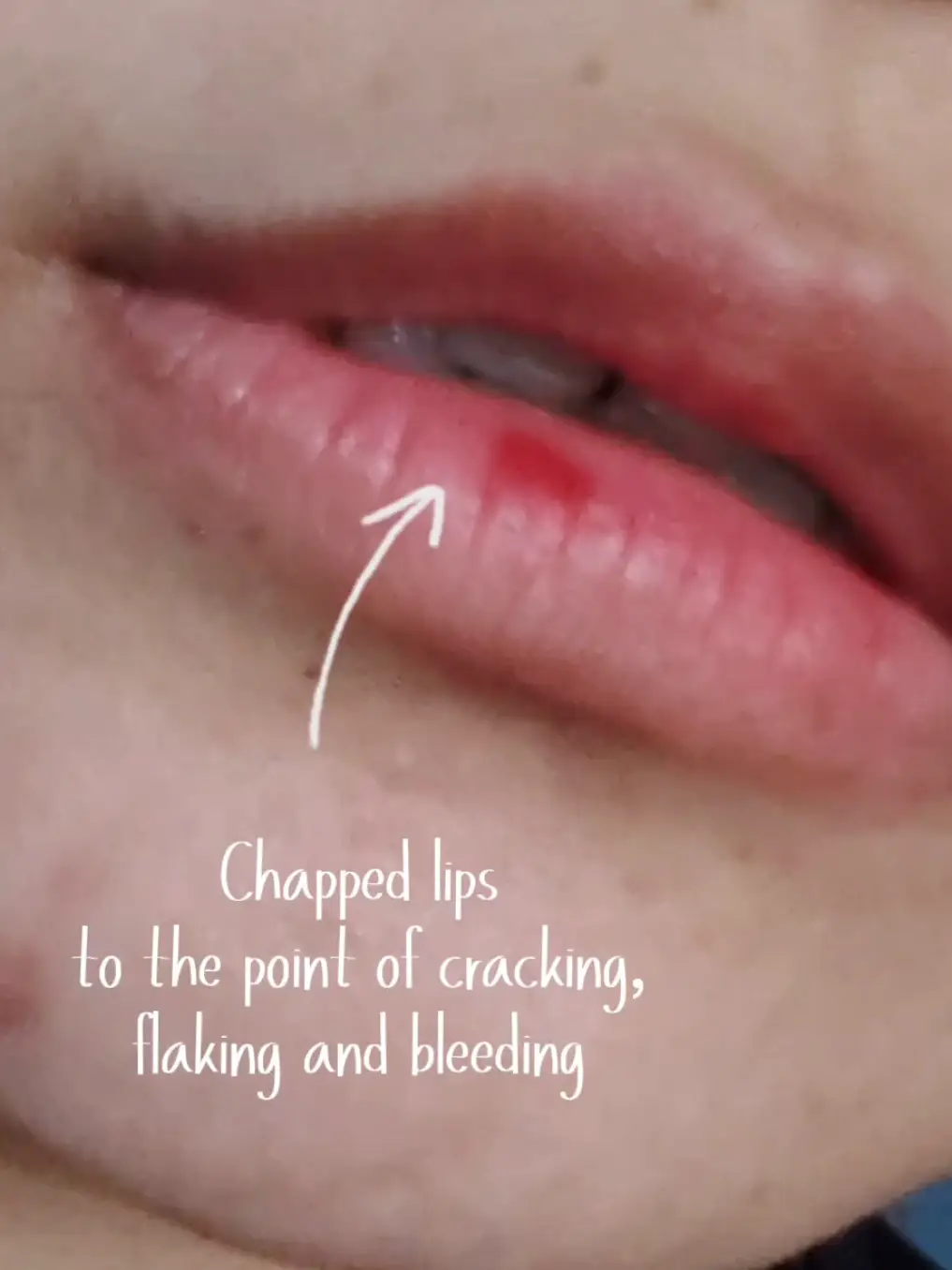 Tiktok post preview 2 from @winterskyincognito