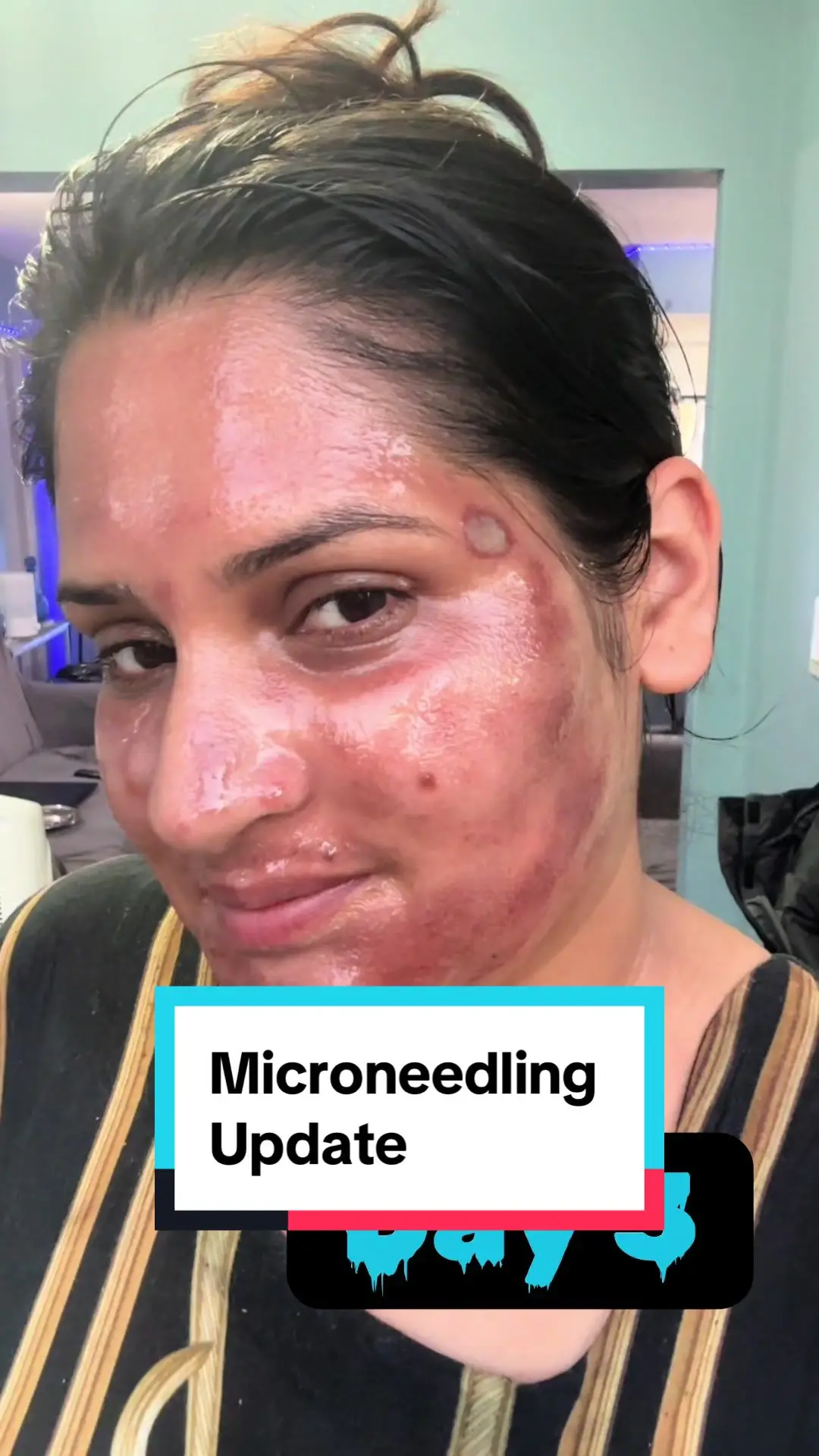 Tiktok post preview 2 from @reviewsbyanam