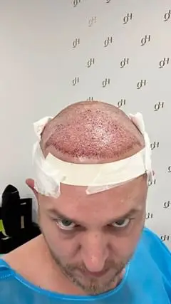 Instagram post thumbnail