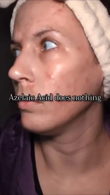 Instagram post preview 1 from atrophicbeauty