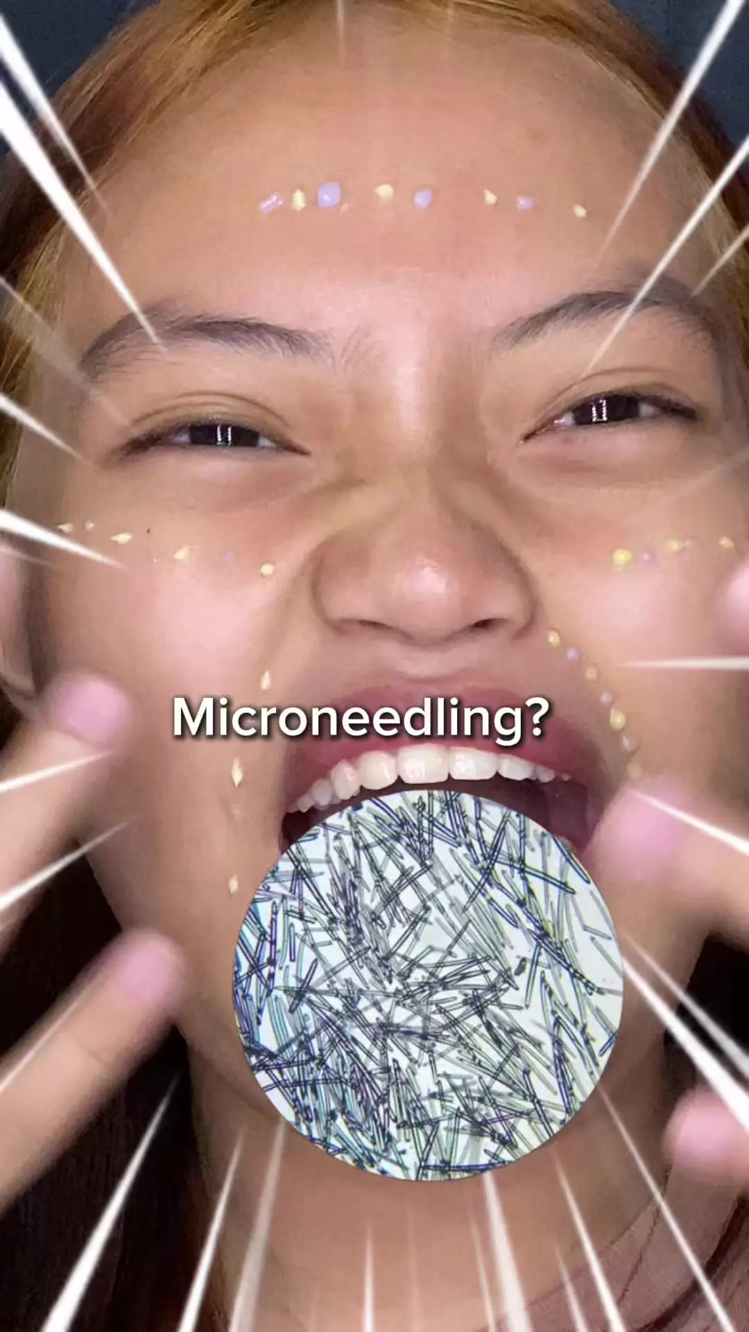 Tiktok post thumbnail