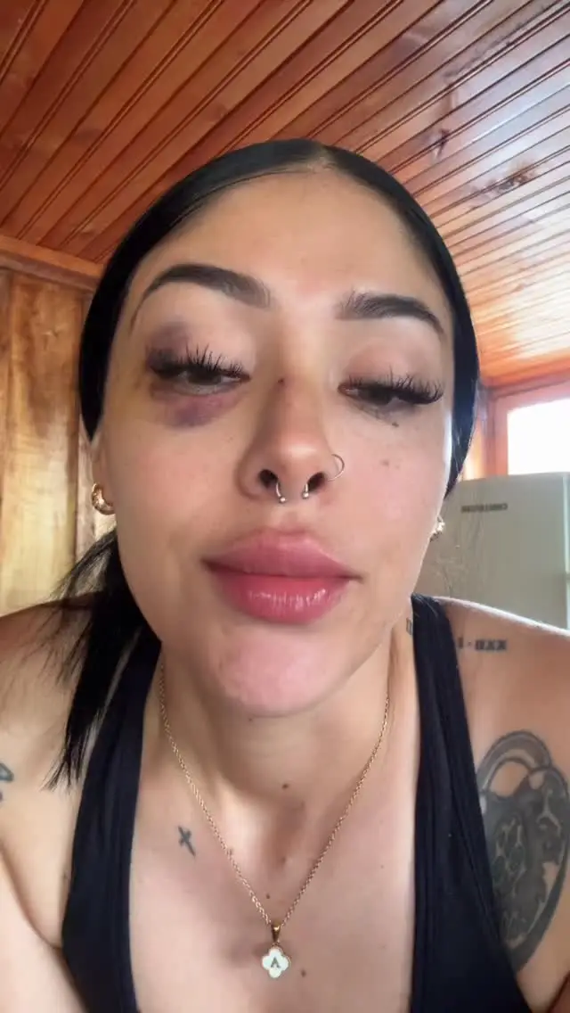 Instagram post thumbnail