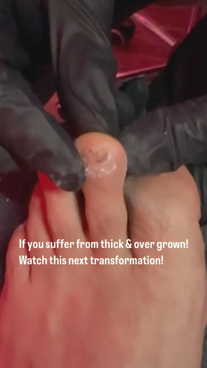 Instagram post thumbnail