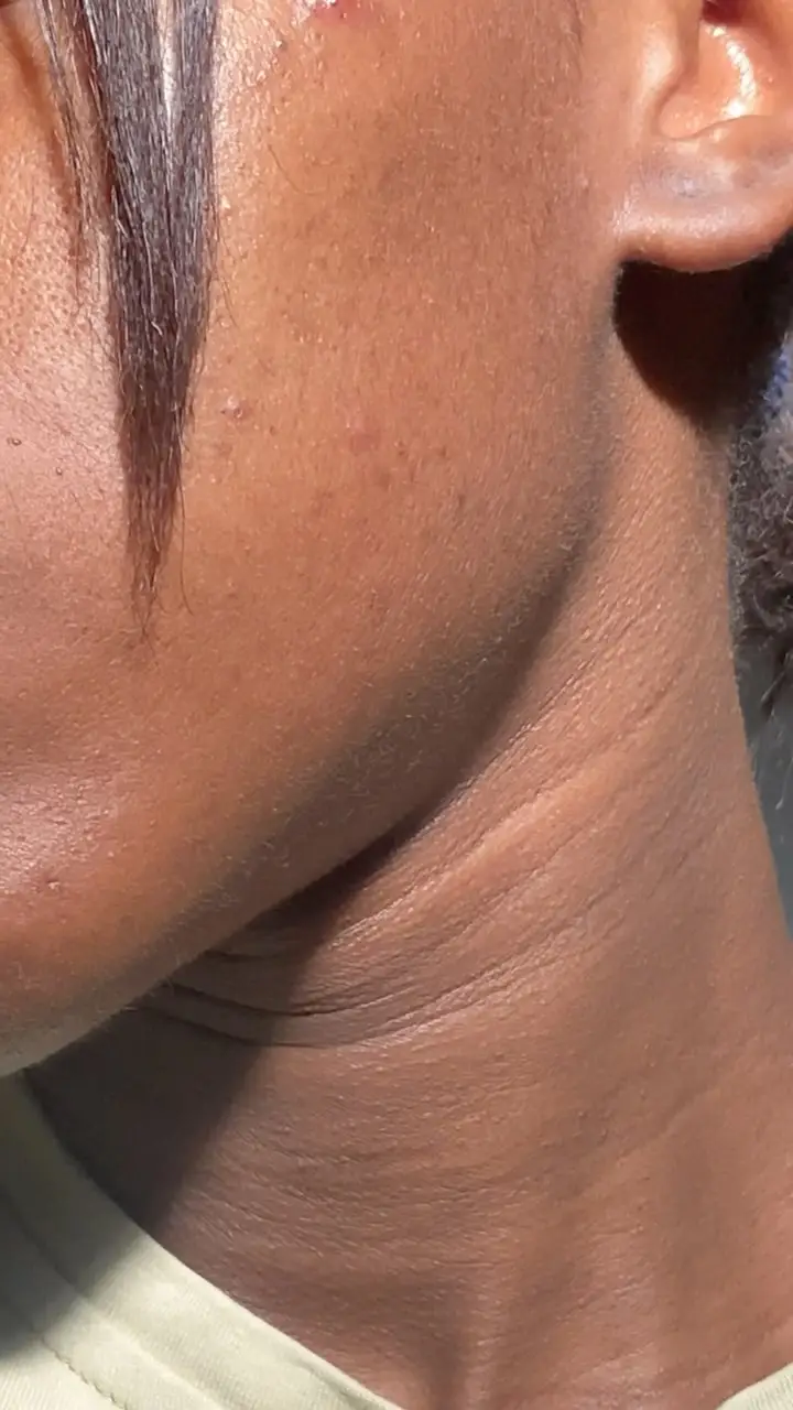 Instagram post thumbnail