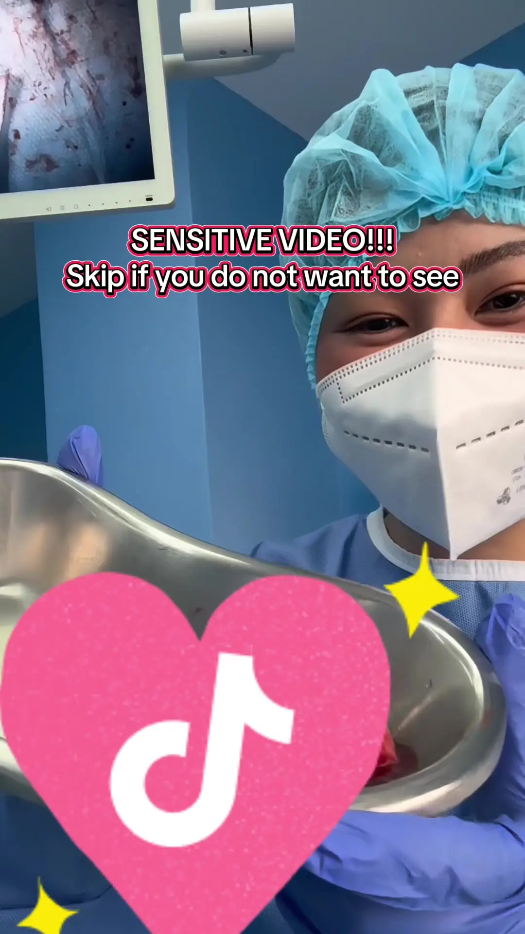 Tiktok post thumbnail