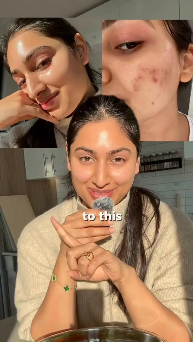 Instagram post thumbnail