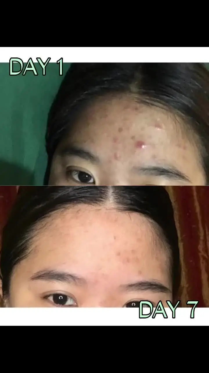 Tiktok post preview 2 from @sharcasimiro