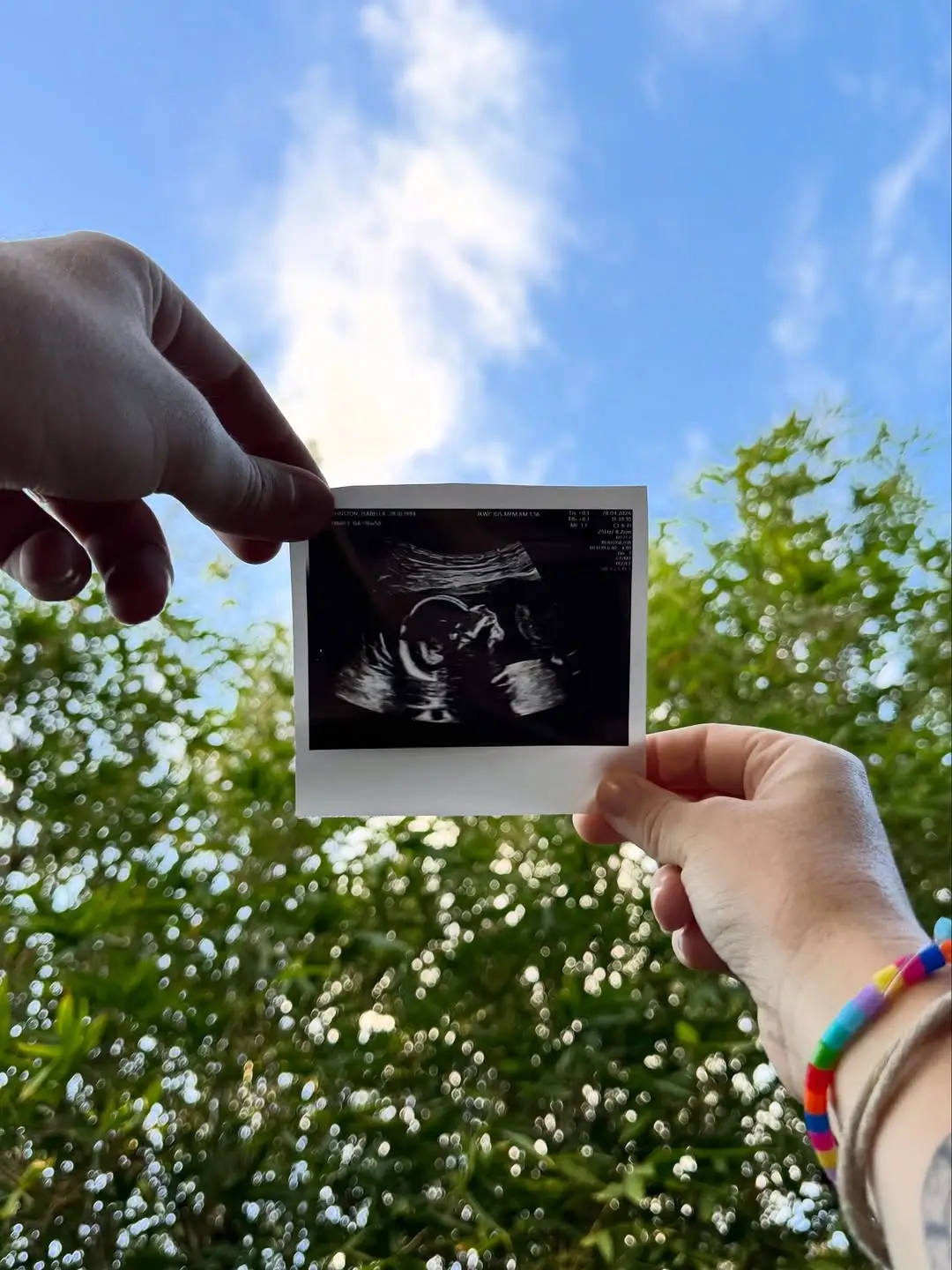 Instagram post thumbnail