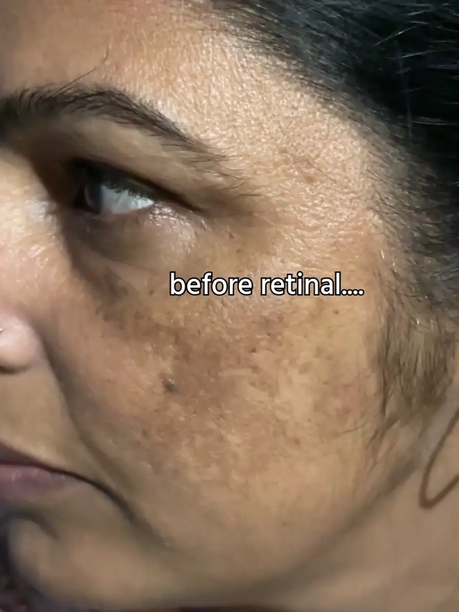 Tiktok post preview 2 from @beautyvibe35