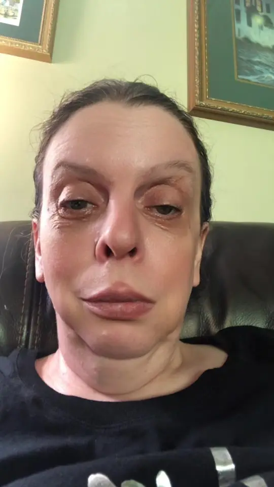 Tiktok post thumbnail