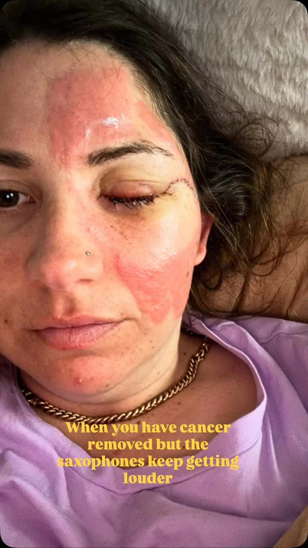 Instagram post thumbnail