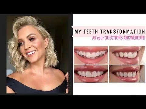Youtube post thumbnail