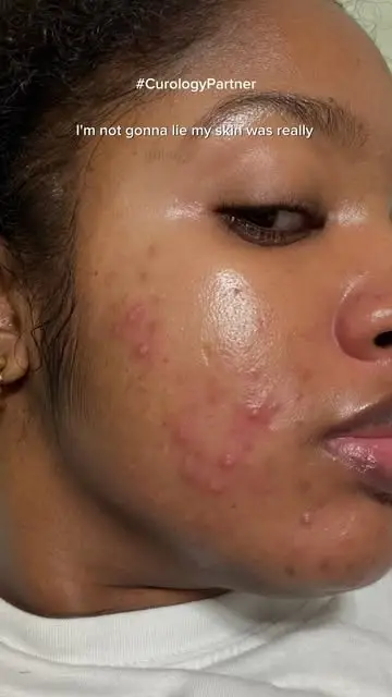Instagram post thumbnail