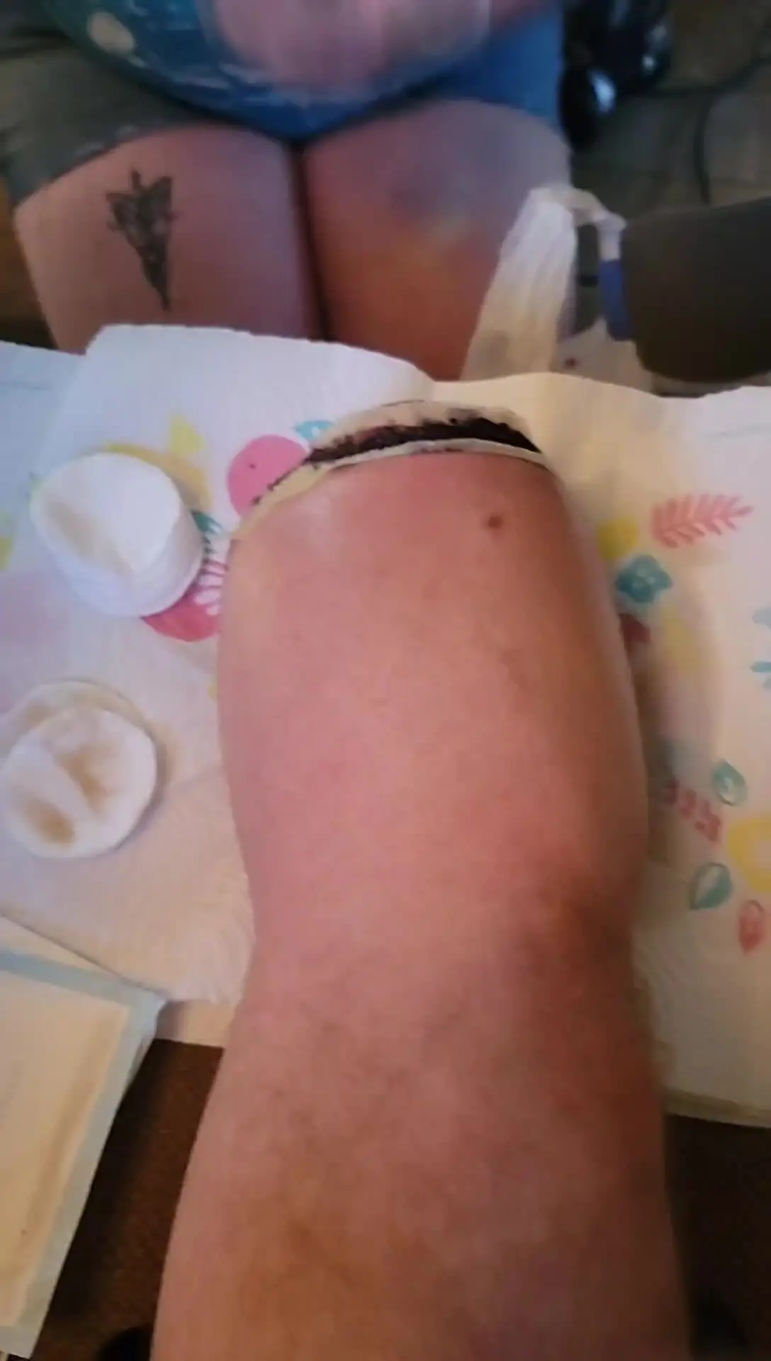 Tiktok post thumbnail