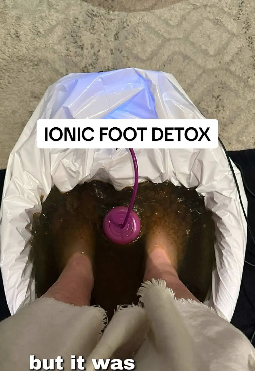 Tiktok post preview 3 from @thrivingwitheczema