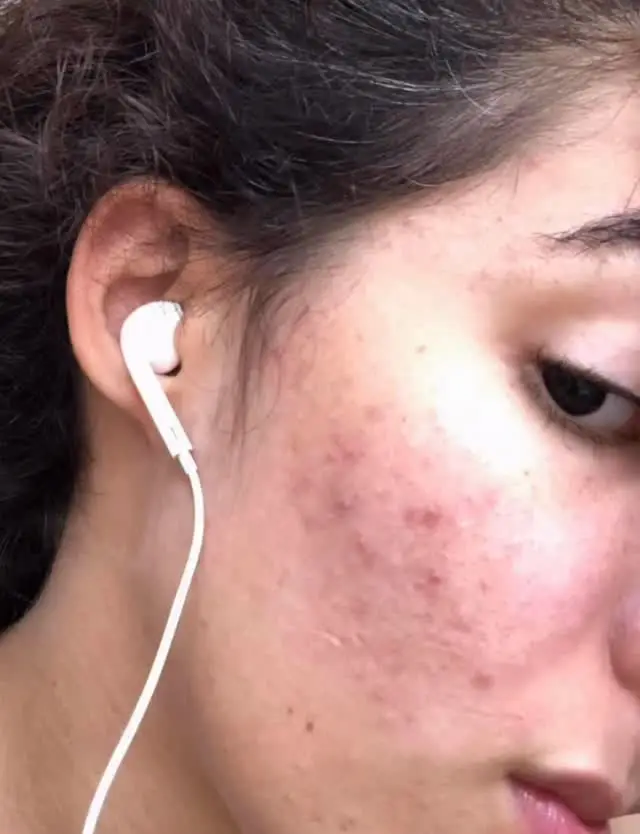 Instagram post thumbnail