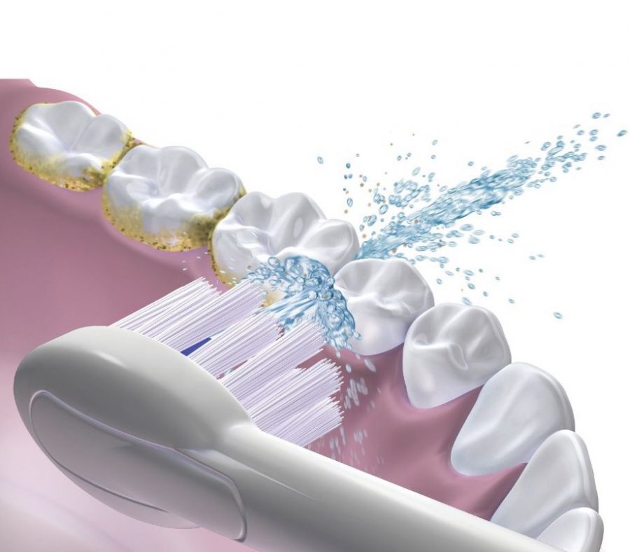 Waterpik Sonic Fusion flossing toothbrush is now available