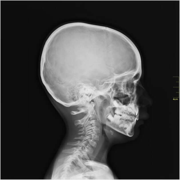 Monitors for Medical Imaging Image Science