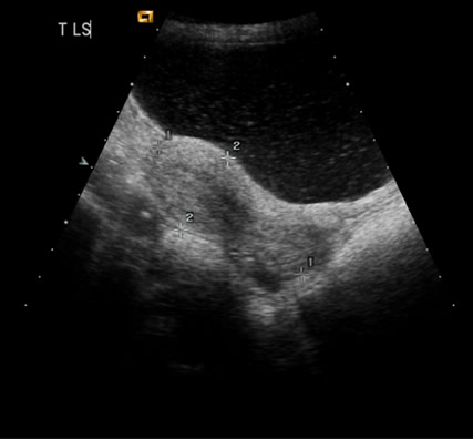 Image1 - thumbnail