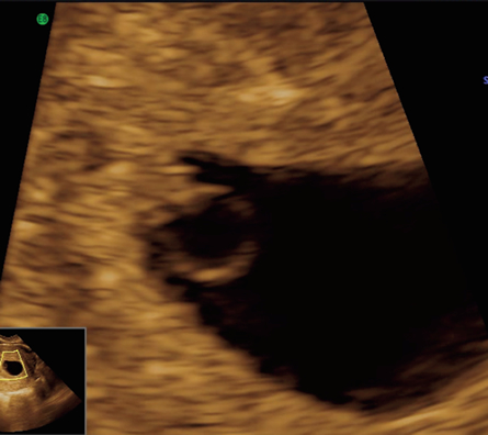 Image1 - thumbnail