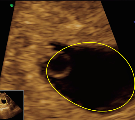 Image2 - thumbnail
