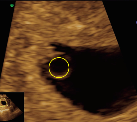 Image4 - thumbnail