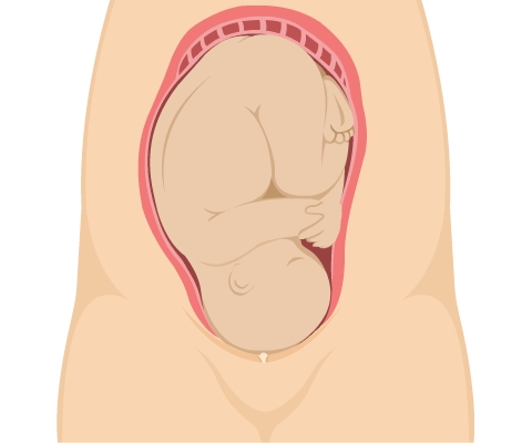 Image1 - thumbnail