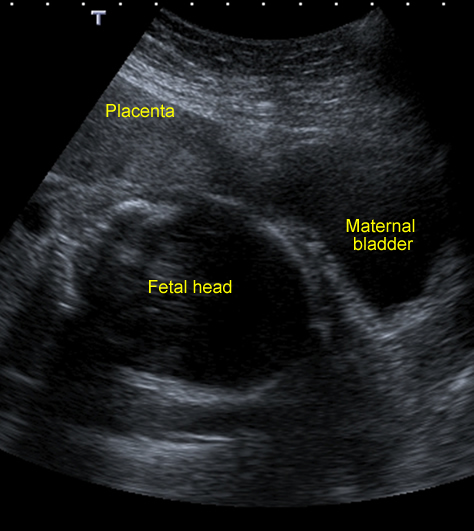 Image1 - thumbnail