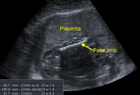 Image2 - thumbnail