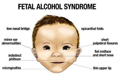 Credit: Plano Children's Medical Clinic