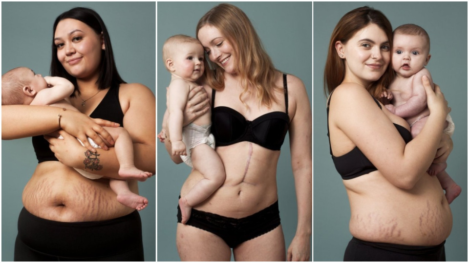 New ad encourages mums to be proud of their post-baby bodies, stretch marks and all